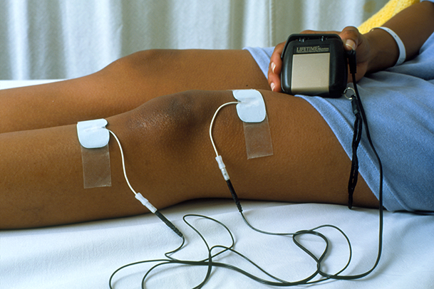 Zap Away Pain: Unleashing the Power of TENS Therapy in Physio