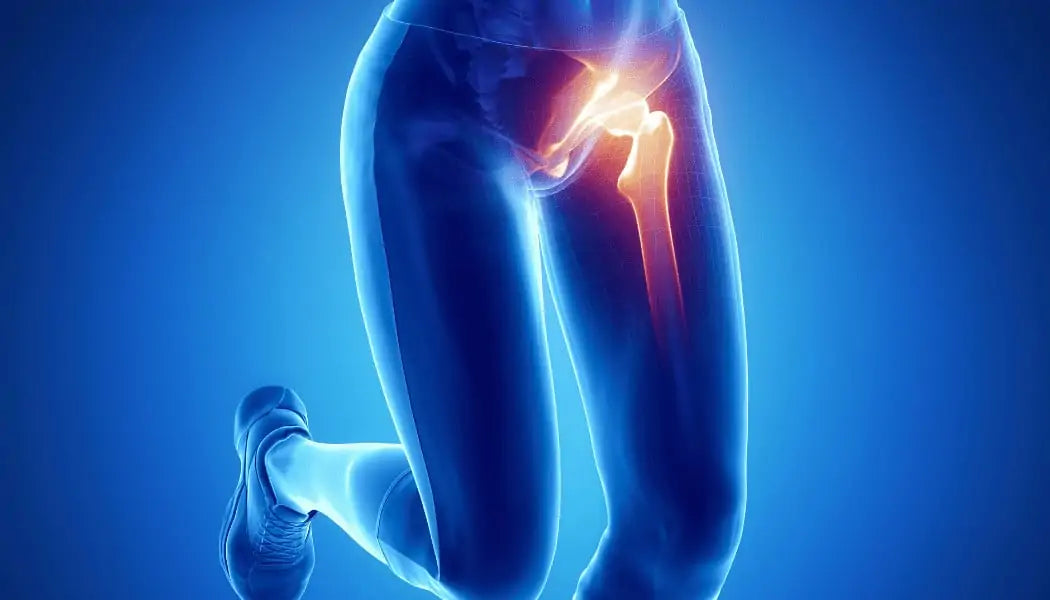 Groin Pain Rehab