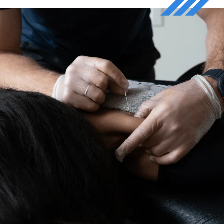 Unlock Relief: IMS Physio, Targeting Pain at Its Core!