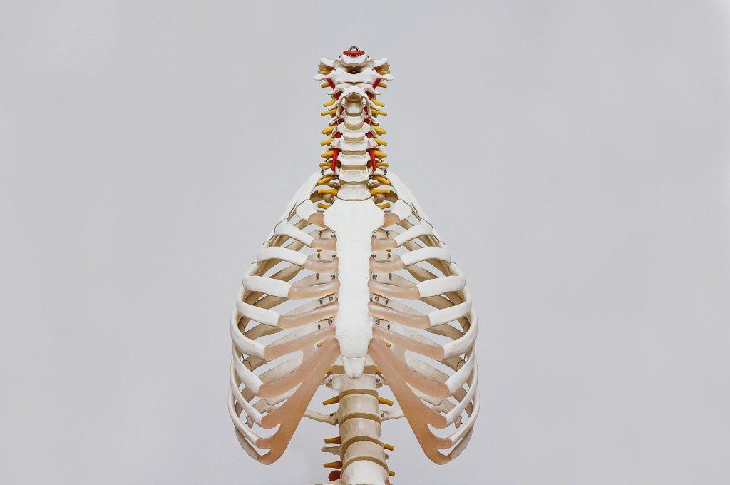 Thoracic Outlet Syndrome: Do I have this?