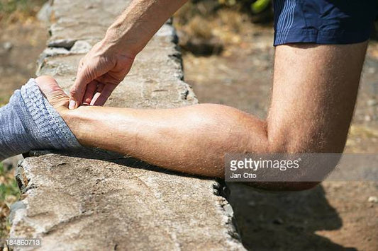 Achilles Rehabilitation – Start Early