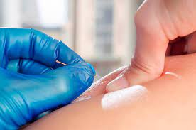 Intramuscular Stimulation