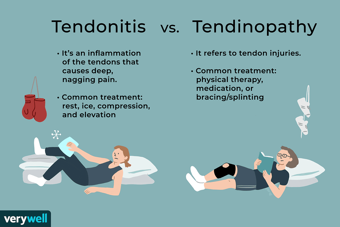 Tendinopathy– What is it?