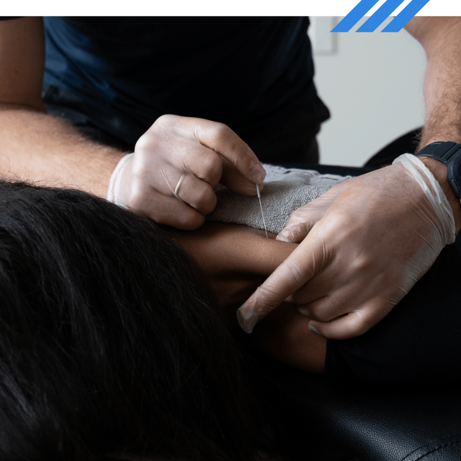 Vancouver Physiotherapy Clinic IMS Therapy Dry Needling